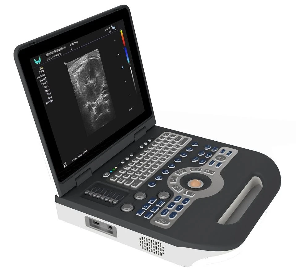 Full-digital Color Doppler Ultrasound Diagnostic System