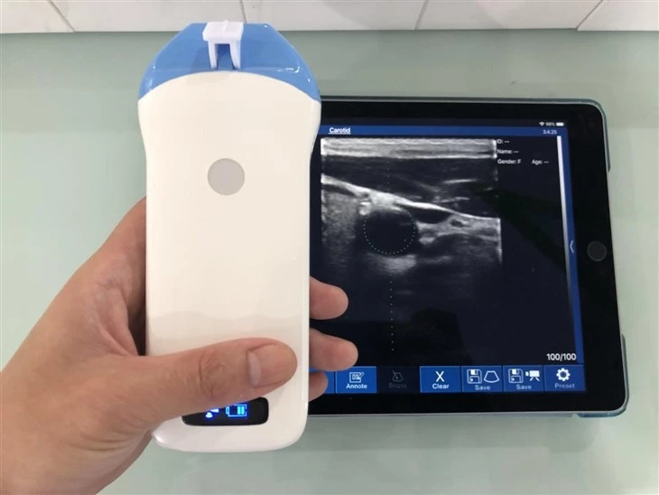 wireless ultrasound wireless ultrasound