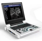 Ultradźwiękowy system diagnostyczny Color Doppler