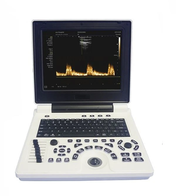 Laptop Color Doppler Ultradźwiękowy system diagnostyczny