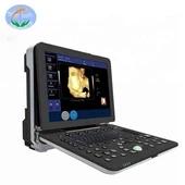 YJ-C90 Wysokiej klasy przenośny ultrasonograf USG Color Doppler dla szpitala i kliniki