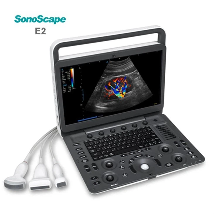 sonoscape e2 ultrasound sonoscape e2 ultrasound